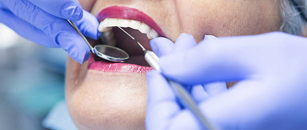 Best Emergency Tooth Extraction  in Del Aire, CA